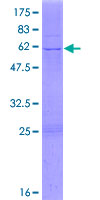 HIBADH Protein - 12.5% SDS-PAGE of human HIBADH stained with Coomassie Blue