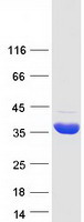 HIBADH Protein - Purified recombinant protein HIBADH was analyzed by SDS-PAGE gel and Coomassie Blue Staining