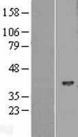 HIBCH Protein - Western validation with an anti-DDK antibody * L: Control HEK293 lysate R: Over-expression lysate