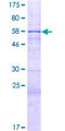 HIBCH Protein - 12.5% SDS-PAGE of human HIBCH stained with Coomassie Blue