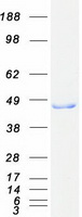 HIBCH Protein - Purified recombinant protein HIBCH was analyzed by SDS-PAGE gel and Coomassie Blue Staining