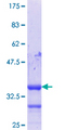 HIC1 Protein - 12.5% SDS-PAGE Stained with Coomassie Blue.
