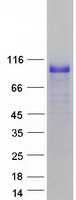 HIC1 Protein - Purified recombinant protein HIC1 was analyzed by SDS-PAGE gel and Coomassie Blue Staining