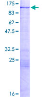 HIC2 Protein - 12.5% SDS-PAGE of human HIC2 stained with Coomassie Blue