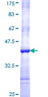 HIC2 Protein - 12.5% SDS-PAGE Stained with Coomassie Blue.