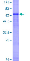 HIF1AN Protein - 12.5% SDS-PAGE of human HIF1AN stained with Coomassie Blue