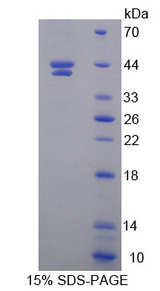 HIF1AN Protein - Recombinant  Hypoxia Inducible Factor 1 Alpha Subunit Inhibitor By SDS-PAGE