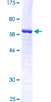HIF2A / EPAS1 Protein - 12.5% SDS-PAGE Stained with Coomassie Blue.