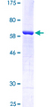 HIF2A / EPAS1 Protein - 12.5% SDS-PAGE Stained with Coomassie Blue.