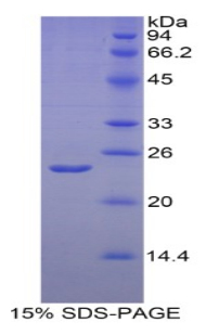HIF2A / EPAS1 Protein - Recombinant Hypoxia Inducible Factor 2 Alpha By SDS-PAGE