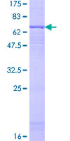 HIF3A / HIF3-Alpha Protein - 12.5% SDS-PAGE of human HIF3A stained with Coomassie Blue