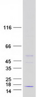 HIGD2A Protein - Purified recombinant protein HIGD2A was analyzed by SDS-PAGE gel and Coomassie Blue Staining