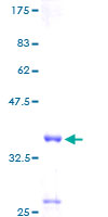 HIN-1 / SCGB3A1 Protein - 12.5% SDS-PAGE of human SCGB3A1 stained with Coomassie Blue