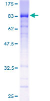 HINFP Protein - 12.5% SDS-PAGE of human MIZF stained with Coomassie Blue