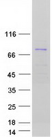 HINFP Protein - Purified recombinant protein HINFP was analyzed by SDS-PAGE gel and Coomassie Blue Staining