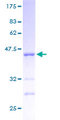 HINT / HINT1 Protein - 12.5% SDS-PAGE of human HINT1 stained with Coomassie Blue
