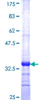 HINT / HINT1 Protein - 12.5% SDS-PAGE Stained with Coomassie Blue.