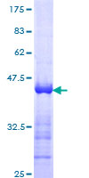 HIP1 Protein - 12.5% SDS-PAGE Stained with Coomassie Blue.