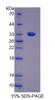 HIP1 Protein - Recombinant Huntingtin Interacting Protein 1 (HIP1) by SDS-PAGE