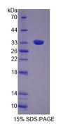 HIP1 Protein - Recombinant Huntingtin Interacting Protein 1 (HIP1) by SDS-PAGE