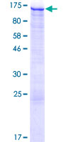 HIP1R Protein - 12.5% SDS-PAGE of human HIP1R stained with Coomassie Blue