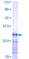 HIP1R Protein - 12.5% SDS-PAGE Stained with Coomassie Blue.