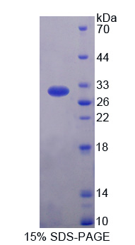 HIP1R Protein - Recombinant  Huntingtin Interacting Protein 12 By SDS-PAGE