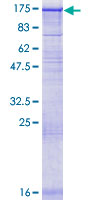 HIPK1 Protein - 12.5% SDS-PAGE of human HIPK1 stained with Coomassie Blue