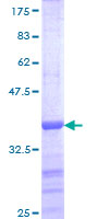HIPK1 Protein - 12.5% SDS-PAGE Stained with Coomassie Blue.