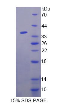 HIPK1 Protein - Recombinant Homeodomain Interacting Protein Kinase 1 By SDS-PAGE