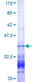 HIPK3 / FIST Protein - 12.5% SDS-PAGE Stained with Coomassie Blue.