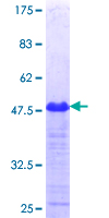 HIPK4 Protein - 12.5% SDS-PAGE Stained with Coomassie Blue