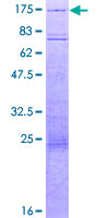 HIRA Protein - 12.5% SDS-PAGE of human HIRA stained with Coomassie Blue