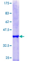 HIRA Protein - 12.5% SDS-PAGE Stained with Coomassie Blue.