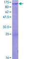 HIRIP3 Protein - 12.5% SDS-PAGE of human HIRIP3 stained with Coomassie Blue