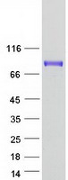 HIRIP3 Protein - Purified recombinant protein HIRIP3 was analyzed by SDS-PAGE gel and Coomassie Blue Staining