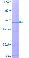 HIST1H1A Protein - 12.5% SDS-PAGE of human HIST1H1A stained with Coomassie Blue