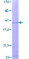 HIST1H1A Protein - 12.5% SDS-PAGE of human HIST1H1A stained with Coomassie Blue