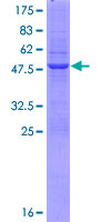 HIST1H1C Protein - 12.5% SDS-PAGE of human HIST1H1C stained with Coomassie Blue