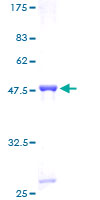 HIST1H2BN Protein - 12.5% SDS-PAGE of human HIST1H2BN stained with Coomassie Blue