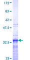 HIST1H3D Protein - 12.5% SDS-PAGE Stained with Coomassie Blue.