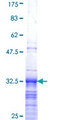 HIST1H3G Protein - 12.5% SDS-PAGE Stained with Coomassie Blue.