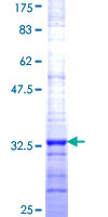 HIST1H4H Protein - 12.5% SDS-PAGE Stained with Coomassie Blue.