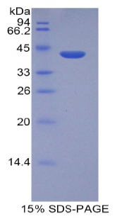 HIST2H2AA3 Protein - Recombinant Histone Cluster 2, H2aa3 By SDS-PAGE