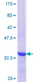 HIST2H2BE Protein - 12.5% SDS-PAGE Stained with Coomassie Blue.