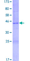 HIST2H3C Protein - 12.5% SDS-PAGE of human HIST2H3C stained with Coomassie Blue