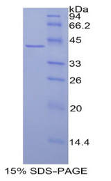 HIST3H2A Protein - Recombinant Histone Cluster 3, H2a By SDS-PAGE