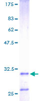Histatin 3 / HTN3 Protein - 12.5% SDS-PAGE of human HTN3 stained with Coomassie Blue