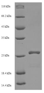 HIV-1 Vif Protein - (Tris-Glycine gel) Discontinuous SDS-PAGE (reduced) with 5% enrichment gel and 15% separation gel.