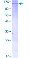 HK1 / Hexokinase 1 Protein - 12.5% SDS-PAGE of human HK1 stained with Coomassie Blue